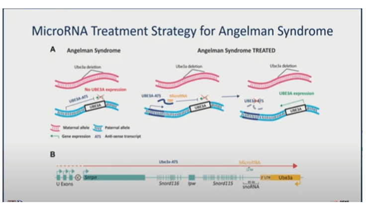 cure sindrome angelman - ricerca traslazione con terapia genica